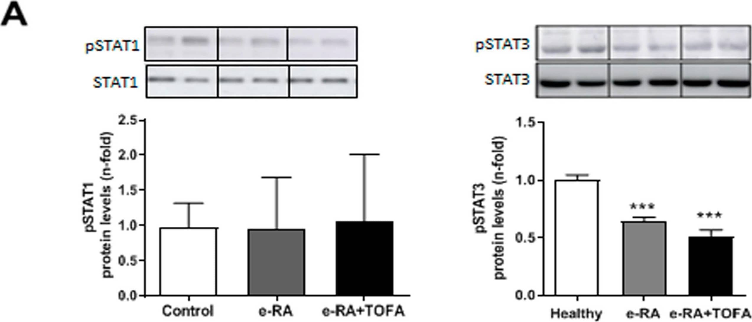 TOFA decreases STAT3 but not STAT1 signaling. (A) Densitometric analysis of pSTAT1 and pSTAT3 protein expression in gastrocnemius. (B) Densitometric analysis of SOCS1 and SOCS3 protein expression in gastrocnemius. Data are normalized to endogenous control ( alpha -tubulin) and expressed as arbitrary units (A.U.). Representative cropped blots of two animals of each group are shown: healthy, e-RA, and e-RA+TOFA, respectively. Data are shown as the mean and SEM (n = 7 rabbits per group). *** p < 0.001 vs. healthy. e-RA: experimental rheumatoid arthritis; TOFA: tofacitinib. Image collected and cropped by CiteAb from the following open publication (//pubmed.ncbi.nlm.nih.gov/37685986), licensed under a CC-BY license. Not internally tested by R&D Systems.