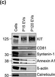 KIT‐EVs are released as heterogeneous subpopulations with different physical properties. (A) Cell culture supernatant was subjected to differential ultracentrifugation to obtain P15 and P120 EV pellets, as illustrated. Where indicated, P15 and P120 EVs were further separated by iodixanol density gradients. Vesicles from each density fraction were pelleted and analyzed. (B) P15 and P120 EVs obtained from HMC‐1.1 cells were analyzed by nanoparticle tracking. Representative concentration and size profiles averaged from five workflow repetitions are depicted. The averaged percentage (%) of different size ranges within the P15 or P120 population is shown on top (bar chart). (C) Representative Western blot of HMC‐1.1 cell, P15 and P120 EV lysates (30 μg) probed with the indicated antibodies. (D, E) HMC‐1.1‐derived P15 (D) or P120 (E) EV pellets were separated by density gradients and the vesicles from each fraction (F1‐F10) were analyzed by nanoparticle tracking for concentration (particles/ml), shown as box plots, and size (represented as average mode, nm), shown as a line graph. Data in the box plots represent the median with the whiskers indicating minimum and maximum values; data in the line graph are represented as mean ± S.D. from five repetitions. Representative results are shown. (F, G) Representative immunoblots showing the presence of KIT and annexin A1 in P15 EV fractions (F) and KIT and CD81 in P120 EV fractions (G). The density (g/ml) of each fraction is indicated below Image collected and cropped by CiteAb from the following open publication (//pubmed.ncbi.nlm.nih.gov/36239715), licensed under a CC-BY license. Not internally tested by R&D Systems.