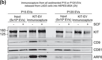 KIT‐EV immunocapture of LAD2 huMC EVs and KIT‐EV recovery from spiked plasma. (A) Cytokine‐starved LAD2 huMCs were treated or not with stem cell factor (SCF; 100 ng/ml) for 2 h in HEPES‐BSA buffer. Cell lysates (30 μg) were analyzed by immunoblotting with the indicated antibodies. (B) EVs released into the supernatant by 18 × 106 LAD2 cells treated or not with SCF for 2 h were sedimented by differential ultracentrifugation into P15 and P120 EVs. KIT‐EV immunocapture was performed (KIT antibody AF332) from all sedimented LAD2 P15 and P120 EVs. The total bead elution was loaded and analyzed by Western blotting with the indicated antibodies. Input EV lysates (5 × 108) were included. Representative blots are shown. (C) HMC‐1.1 cell line‐derived EVs (1.2 × 1010 EVs) were incubated or not in human normal plasma and captured with a KIT antibody (AF332) or by CD9 antibody‐conjugated beads. A goat HA antibody served as a negative isotype control. Representative blots are shown. sKIT, soluble KIT that is present in plasma. Dashed lines imply lanes from the same blot that were not loaded contiguously Image collected and cropped by CiteAb from the following open publication (//pubmed.ncbi.nlm.nih.gov/36239715), licensed under a CC-BY license. Not internally tested by R&D Systems.