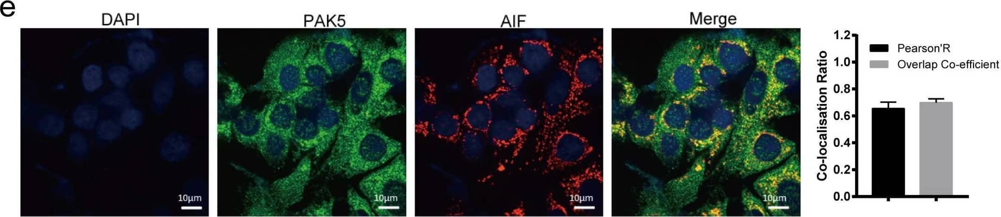 PAK5 directly binds to AIF. (a,b) Endogenous AIF interacts with PAK5. BT474 cells/T47D lysates were immunoprecipitated with the anti-PAK5, anti-AIF or IgG. Precipitates were analyzed by western blot. (c) Exogenous PAK5 interacts with AIF. Total lysates were subjected to immunoprecipitation and western blot. (d) PAK5 directly binds to GST-AIF in vitro. Black stars indicate GST and GST-fusion proteins. (e) Co-localization of PAK5 and AIF. Nucleus was stained with DAPI (4', 6 diamidino-2-phenylindole). Yellow indicates co-localization. Original magnification, ×600. The Pearson's correlation and overlap co-efficient were shown in bar graph format (30 cells) from three independent experiments were analyzed (error bars, SEM). Image collected and cropped by CiteAb from the following open publication (//pubmed.ncbi.nlm.nih.gov/33867848), licensed under a CC-BY license. Not internally tested by R&D Systems.