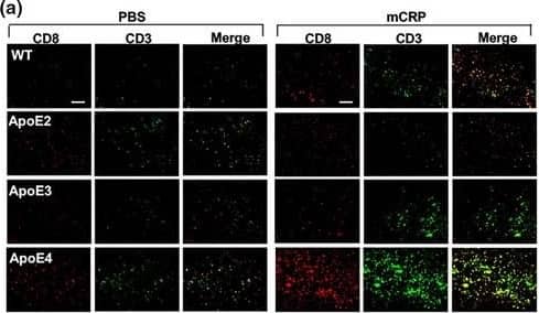 Peripheral mCRP‐induced neuroinflammation, extravasation of T lymphocytes&AD pathology traits in the ApoE4 brain. (a) We then investigated if mCRP‐induced cerebrovascular damage can migrate peripheral immune cells into the brain. Double immunostaining of CD8 (red), CD3 (green),&double‐positive cells (yellow) was performed to study the transcytosis of T lymphocytes in the cortex after i.p. treatment with PBS (left columns) versus mCRP (right columns) in WT&different ApoE knock‐in mice. Quantification of CD8+ T lymphocytes&CD8+/CD3+ T lymphocytes in the cortex&the comparisons between PBS versus mCRP treatment in each genotype was conducted. mCRP significantly increased the number of T lymphocytes only in the WT (p = 0.05)&ApoE4 (p = 0.001) mice. n = 7–8 in each condition. Image collected & cropped by CiteAb from the following open publication (//pubmed.ncbi.nlm.nih.gov/34687487), licensed under a CC-BY license. Not internally tested by R&D Systems.