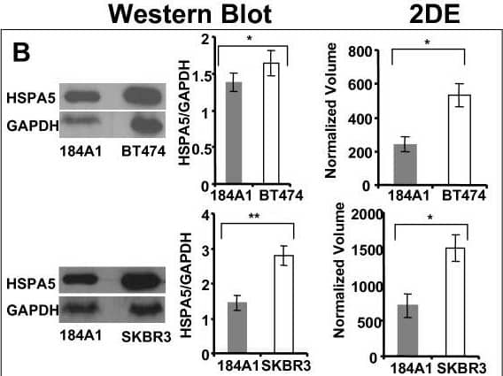 Western blot validation of identified proteins to confirm the expression trend as inferred from 2DE. Protein levels were normalized against GAPDH. Error bars represent S.E.M. * represents (p < 0.05) and ** represents (p < 0.01). Image collected and cropped by CiteAb from the following open publication (//pubmed.ncbi.nlm.nih.gov/22357162), licensed under a CC-BY license. Not internally tested by R&D Systems.