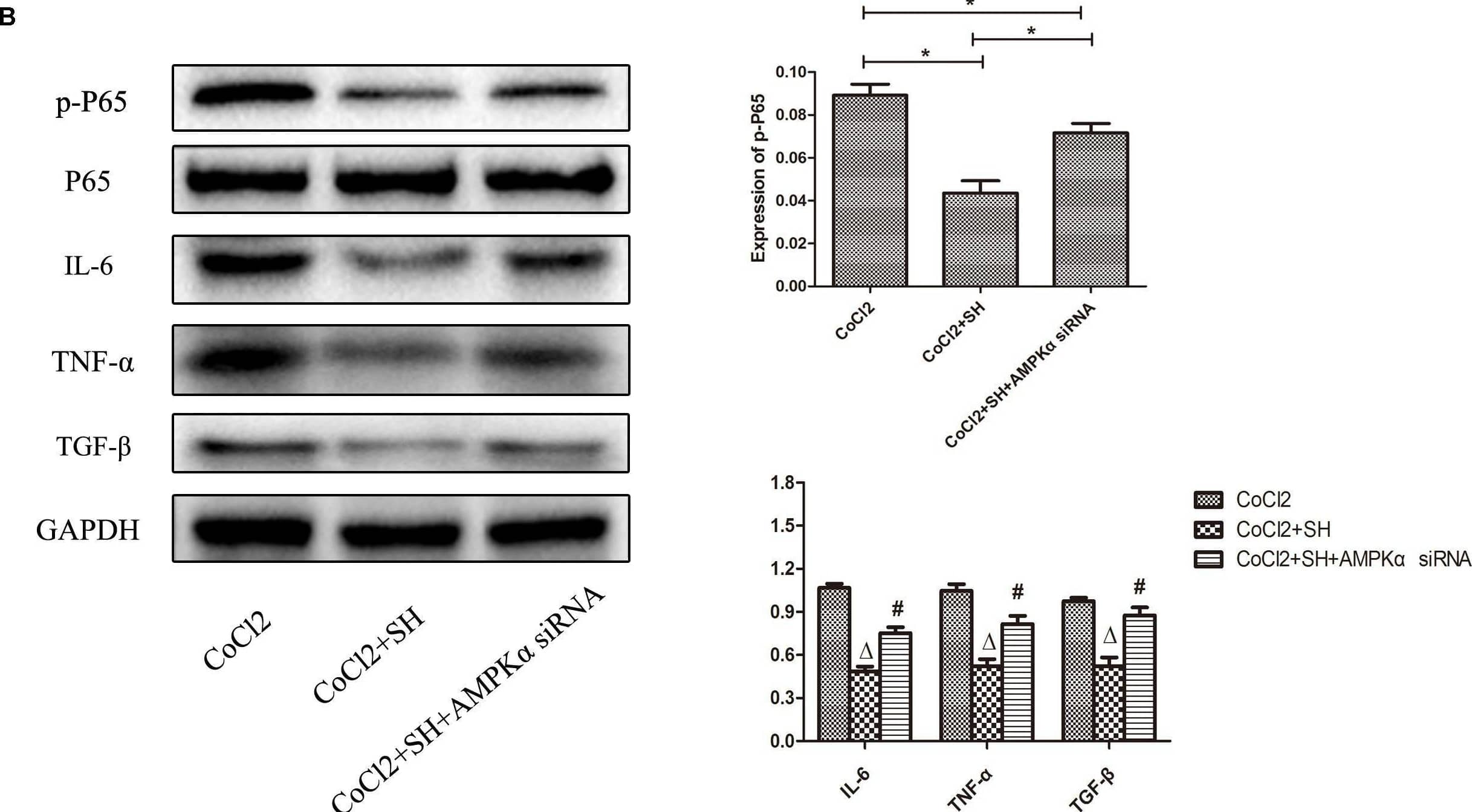 Transfection H9C2 with AMPK alpha  siRNA reversed the suppression of NF-kB p65 and pro-inflammatory cytokines by SH post-hypoxia. (A) The expression of AMPK of H9C2 transfected with AMPK alpha  siRNA. Control, n = 6; non-target siRNA, n = 6; AMPK alpha  siRNA, n = 6. NS indicated p > 0.05, ∗indicated p < 0.05. (B) The expression of NF-kB p65, IL-6 and TNF alpha  of H9C2 transfected with AMPK alpha  siRNA. CoCl2, n = 6; CoCl2+SH, n = 6; CoCl2+SH+AMPK alpha  siRNA, n = 6. ∗Indicated p < 0.05;  delta compared with CoCl2 group, p < 0.05; #compared with CoCl2+SH group, p < 0.05. Image collected and cropped by CiteAb from the following open publication (//pubmed.ncbi.nlm.nih.gov/30319423), licensed under a CC-BY license. Not internally tested by R&D Systems.