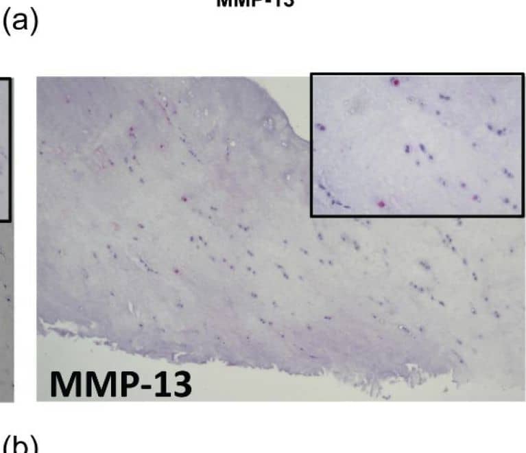 Immunohistochemistry MMP-13 Antibody (87512) [Unconjugated]