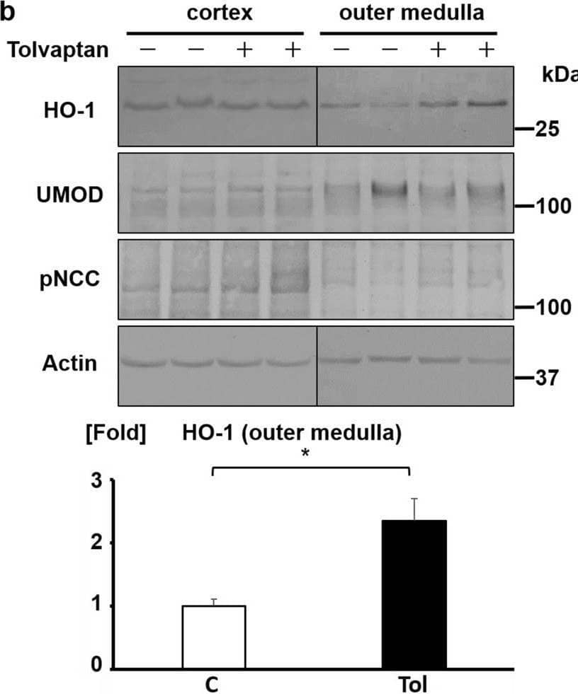 Tolvaptan induces Nrf2 nuclear translocation and HO-1 expression in vivo. (a) Tolvaptan promotes Nrf2 nuclear translocation in the outer medulla of mouse kidneys. (Top panel) Male C57BL/6J mice aged 8–9-weeks were fed with a diet containing 0.5% tolvaptan for 24 h. The nuclear extract was obtained from the outer medulla. Arrow indicates the band of Nrf2. (Bottom panel) Nrf2 bands were quantified using densitometric analysis. Bar indicates average from four or five experiments (control: n = 4, tolvaptan: n = 5). Student’s t-test, **P < 0.01. C: control, Tol: 0.5% tolvaptan. (b) Tolvaptan increases HO-1 protein expression in the outer medulla of mouse kidneys. (Top panel) Tolvaptan (0.5%) was administered via diet to 8–9-week-old male C57BL/6J mice for 24 h. The kidneys were separated into the cortex and the outer medulla, and the whole protein extraction was performed. The blots of HO-1 and Actin were configured with the blot of cortex and that of outer medulla. Fractionation of the cortex and the outer medulla was verified using UMOD and pNCC antibodies. (Bottom panel) Densitometric analysis of HO-1 is shown. Bar indicates average from four or five experiments (control: n = 4, tolvaptan: n = 5). Student’s t-test, *P < 0.05. C: control, Tol: 0.5% tolvaptan. Image collected and cropped by CiteAb from the following open publication (//pubmed.ncbi.nlm.nih.gov/31239473), licensed under a CC-BY license. Not internally tested by R&D Systems.