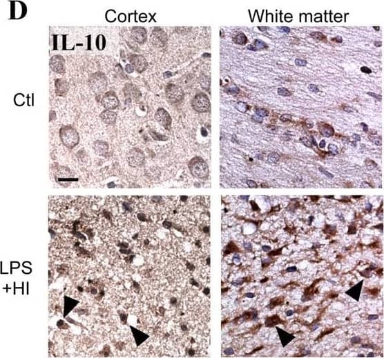 Comparison between P1 and P12 immunostaining intensities of IL-6 and IL-10 in brain. IL-6 and IL-10 expressions were increased only at P12 in brains of rat pups exposed to HI+/- LPS. Data are presented (A, C) as fold increase of IL-6 and IL-10 expressions compared to control (set at 1). (B) Increased IL-6 staining (arrowheads) in P12 spongiotic frontal cortex (pyknotic neurons with abnormal reduced contrast between nucleus and cytoplasm), and spongiotic underlying external capsule following LPS+HI exposure compared to control. (D) Increased IL-10 staining (arrowheads) in P12 lesioned frontal cortex and underlying external capsule exposed to LPS+HI compared to control. IHC was performed at 48 h post-HI, in 3 to 4 brains under each experimental condition. *p < 0.05, **p < 0.01, ***p < 0.001, one-way ANOVA with Newman-Keuls post test. Scale bars = 15 μm (B, D) Image collected and cropped by CiteAb from the following open publication (//pubmed.ncbi.nlm.nih.gov/21599903), licensed under a CC-BY license. Not internally tested by R&D Systems.