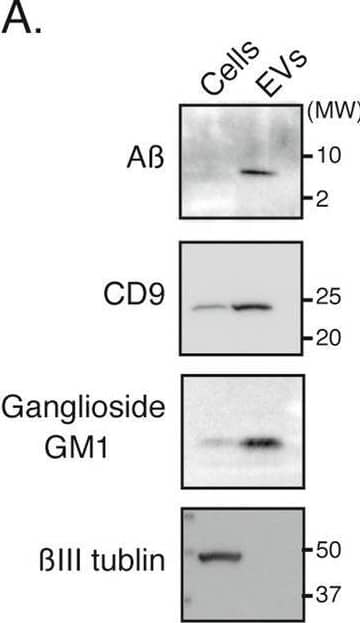 Quantification of A beta -bound and GM1-containing EVs using the idICA. A Western blot analysis of A beta , ganglioside GM1, and  beta III tubulin in APP-N2a cell lysates (1 × 105 cells/lane) and EVs (1 × 107 cells/lane). B Representative fluorescent images of various concentrations of APP-N2a-derived EVs in the idICA, which is constructed from CTB capture and anti-A beta  detection. Each image displays a block of well array corresponding to 10,000 microwells. Scale bar, 200 μm. C, D The ratio of fluorescent beads to trapped beads in a block of well array is plotted as the concentration of A beta  captured on CTB-coated beads (CTB-BAN50) in APP-N2a-derived EVs. Plots on the semi-logarithmic (C) and linear (D) scales are shown. Data represent mean ± SD (n = 3 each). E Representative images of APP-N2a-derived EVs (2500 ng protein) in the double color idICA using anti-CD9 antibody and BAN50. Each image displays a block of well array corresponding to 10,000 microwells. Scale bar, 200 μm. F The ratio of BAN50 or CD9 fluorescent beads to trapped beads. G The overlap rate between BAN50 and CD9 fluorescent beads. Data represent mean ± SD (n = 5 each) Image collected and cropped by CiteAb from the following open publication (//pubmed.ncbi.nlm.nih.gov/36184615), licensed under a CC-BY license. Not internally tested by R&D Systems.
