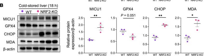 GPX4 pathway is dispensable in cold stress–induced liver injury. Western blot–assisted detection and relative intensity ratio of MICU1, GPX4, CHOP, and MDA in WT and NRF2-deficient (NRF2-KO) (A) naive livers and (B) 18-hour cold-stored livers. Expression of  beta -actin served as the internal control and was used for normalization (n = 3/group). (C) WT livers stored in UW solution (4°C/18 h) with/without RSL3 (GPX4 inhibitor) were perfused with PBS (2 mL) through a cuff placed at the portal vein to collect liver flush from inferior vena cava. (D) Western blot–assisted detection of MDA and HMGB1 in the liver flush (5 μL) from cold-stored livers (n = 4/group). (E) LDH and (F) AST/ALT levels (U/L) in the liver flush (n = 4/group). Purple circle: WT livers; pink circle: NRF2-KO livers. Data are shown as mean ± SEM. *P < 0.05, **P < 0.01, Student’s t test (A and B), 1-way ANOVA followed by Tukey’s HSD test (D−F). Image collected and cropped by CiteAb from the following open publication (//pubmed.ncbi.nlm.nih.gov/38329125), licensed under a CC-BY license. Not internally tested by R&D Systems.