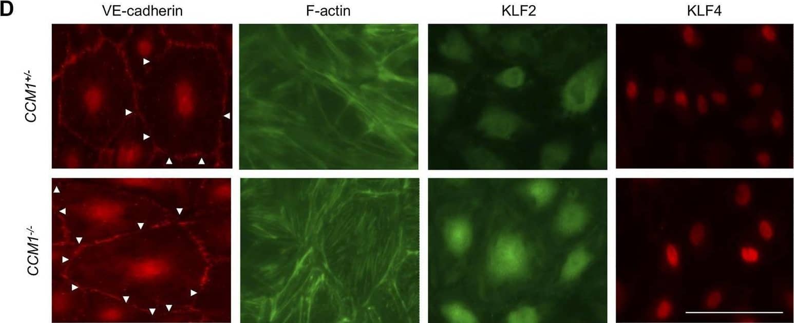 Characterization of CCM1+/− and clonally expanded CCM1−/− BOECS. (A)CCM1−/− BOECs were established by limiting dilution of the CRISPR/Cas9 RNP-treated cell pool and clonal expansion of single cells (created with BioRender.com). (B) Shown are the genotypes of CCM1−/− BOEC clones included in this study. All variants either lead to a frameshift or a premature stop codon (additional information on the CRISPR/Cas9-induced mutations and numbers of individual clones are given in Supplementary Table S1). (C)CCM1−/− BOECs presented a more compact morphology in brightfield microscopy and increased tube formation. The largest cell diameter and the number of meshes formed on Matrigel-coated plates were quantified. Scale bar indicates 400 µm. Data are presented as single data points with the mean (n = 4–6). (D) Immunofluorescence staining revealed a higher number of intercellular gaps (white arrowheads), more actin stress fibers, and a higher expression of KLF2 and KLF4 in CCM1−/− BOECs. Representative images are shown. Scale bar indicates 100 µm. Individual data points are shown with the mean (n = 3–5). Student’s t test was used for statistical analysis: *p < 0.05; **p < 0.01; ****p < 0.0001; ns = not significant; VE-cadherin = vascular endothelial cadherin. Image collected and cropped by CiteAb from the following open publication (//pubmed.ncbi.nlm.nih.gov/34307446), licensed under a CC-BY license. Not internally tested by R&D Systems.