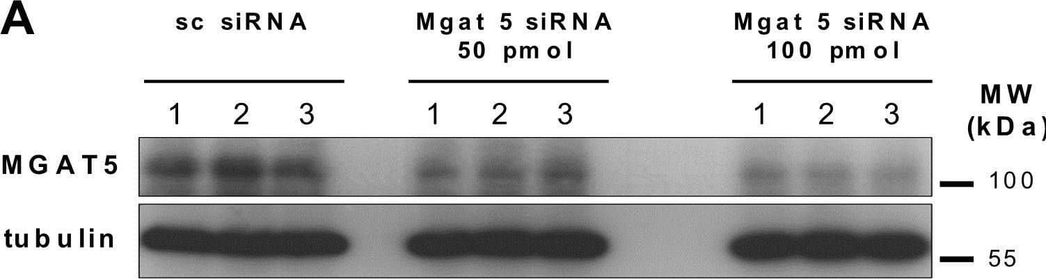 Western Blot N-Acetylglucosaminyltransferase V/MGAT5 Antibody (706824)