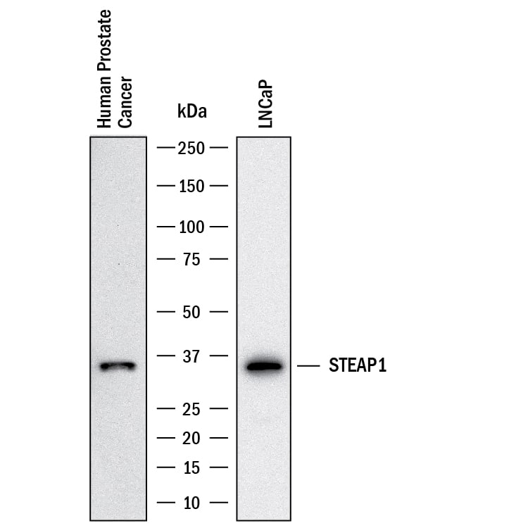 Western blot shows lysates of Human prostate cancer and LNCaP. PVDF membrane was probed with 0.5 µg/mL of Rabbit Anti-Human STEAP1 Monoclonal Antibody (Catalog # MAB55871) followed by HRP-conjugated Anti-Rabbit IgG Secondary Antibody (Catalog # HAF008). A specific band was detected for STEAP1 at approximately 36 kDa (as indicated). This experiment was conducted under reducing conditions and using Western Blot Buffer Group 1.