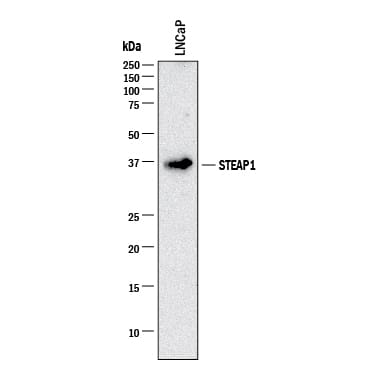 Western blot shows lysates of LNCaP human prostate cancer cell line. PVDF membrane was probed with 2 µg/mL of Mouse Anti-Human STEAP1 Monoclonal Antibody (Catalog # MAB5587) followed by HRP-conjugated Anti-Mouse IgG Secondary Antibody (Catalog # HAF018). A specific band was detected for STEAP1 at approximately 36 kDa (as indicated). This experiment was conducted under reducing conditions and using Western Blot Buffer Group 1.