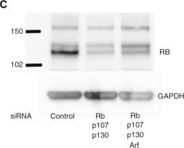 Simultaneous knockdown of multiple genes in primary human islets following electroporation. (A) Graph shows RT-qPCR results of islets electroporated with non-targeting control siRNA or siRNA targeting RB and p130 (L-003299). (B) Graph shows RT-qPCR results of islets electroporated with non-targeted control siRNA or siRNAs targeting the indicated gene products. The housekeeping gene GAPDH was used as the control. Representative experiment shown from 3 separate experiments. Error bars indicate standard deviation. (C) Western blot for RB protein in human islet lysates after electroporation of control or targeting siRNA. GAPDH was used as a loading control. RB appears as a characteristic doublet representing the hypo and hyperphosphorylated protein. Representative experiment shown from 3 different experiments. Image collected and cropped by CiteAb from the following open publication (//pubmed.ncbi.nlm.nih.gov/25305068), licensed under a CC-BY license. Not internally tested by R&D Systems.