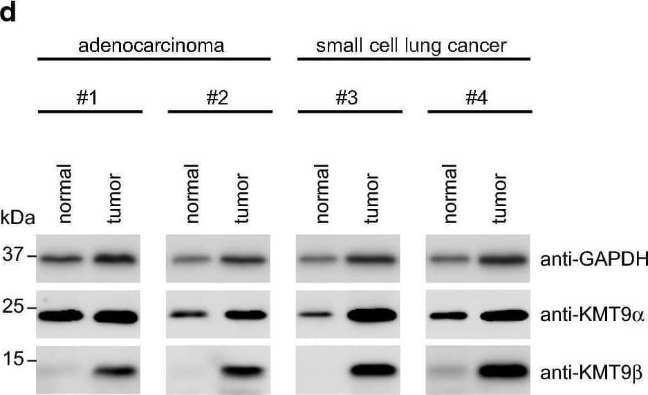 KMT9 is expressed in lung cancer tissue and cell lines. a Dynamics of KMT9 alpha  expression in matched normal and stage 1a lung adenocarcinoma tissue from eleven patients that underwent curative lobectomy. Normal samples were taken at 6 cm distance from macroscopic tumor sites. Data were extracted from (GSE83213). Red lines indicate increased expression of KMT9 alpha  in tumor (n = 8), green lines indicate decreased expression of KMT9 alpha  in tumor (n = 3). b TCGA data comparing KMT9 alpha  expression in n = 515 lung adenocarcinoma with non-matched normal lung tissue (n = 59). Data represent interquartile range including minimum, 25th percentile, median, 75th percentile and maximum values. Significance was accessed by t test. c Kaplan–Meier survival analysis of patients with adenocarcinoma expressing high (n = 58) and low (n = 57) KMT9 alpha . Data were extracted from GSE26939. HR = hazard ratio. d Western blots of matched tissue from normal and tumor samples from patients with adenocarcinoma (#1 and #2) or SCLC (#3 and #4). Western blots were performed with the indicated antibodies. e Expression levels of KMT9 alpha  and KMT9 beta  in human cell lines from SCLC (GLC-2 and NCI-H82), adenocarcinoma (A549, PC-9 and NCI-H2087) and human immortalized normal lung fibroblasts (CRL-7000 and IMR-90) were analyzed by western blot using the indicated antibodies. f In A549 cells, KMT9 alpha  and KMT9 beta  are present in both nuclear and cytoplasmic compartments. Western blots were performed with the indicated antibodies. g Levels of H4K12me1 in SCLC (GLC-2 and NCI-H82) and adenocarcinoma (A549, PC-9 and NCI-H2087) cells were analyzed by western blotting using the indicated antibodies Image collected and cropped by CiteAb from the following open publication (//pubmed.ncbi.nlm.nih.gov/32095117), licensed under a CC-BY license. Not internally tested by R&D Systems.