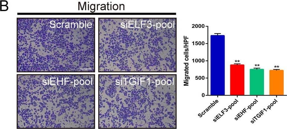 ELF3, EHF, and TGIF1 enhances the malignant phenotypes of LUAD cells.A, B Inhibition of invasive and migrate activity by knockdown master TFs, ELF3, EHF, and TGIF1. PC-9 cells were transfected with indicated siRNA-pool and subjected to invasion and migration assays (see “Materials and methods”). Invaded and migrated cells were stained with crystal violet and counted (see Fig. S3). Histograms represent the number of invasion or migration. Representative photographs were shown. C Colony assay performed on PC-9 cells transfected with either scramble or siRNA-pool targeting ELF3, EHF, and TGIF1. D Silencing of ELF3, EHF, and TGIF1 increased clonal cell growth in a 3D spheroid culture system. PC-9 cells transfected with scramble or siRNA-pool were cultured as spheroid in DMEM medium and the spheroids was observed after 48 h. E Inhibition of cell migration by knockdown master TFs, ELF3, EHF, and TGIF1. PC-9 cells were transfected with indicated siRNA-pool and subjected to scratch assay (see “Materials and methods”). Representative photographs were taken and migration areas were measured. Statistical analysis was performed by using t tests; data are shown as bar graphs of the mean ± SD. of three independent experiments. Scale bars (white) indicate 250 μm. F The effects of pcDNA3.1-ELF3 and/or pcDNA3.1-EHF co-transfected with TGIF1 siRNA on cell migration and invasiveness in LUAD cells were examined by Transwell assays using a Boyden chamber in the presence or absence of Matrigel, respectively. Histograms represent the number of invasion or migration. Data were representative of two to three separate experiments performed in triplicate. *p < 0.05; **p < 0.01; ***p < 0.001. Image collected and cropped by CiteAb from the following publication (//pubmed.ncbi.nlm.nih.gov/33070167), licensed under a CC-BY license. Not internally tested by R&D Systems.