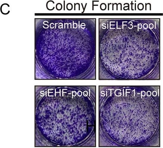 ELF3, EHF, and TGIF1 enhances the malignant phenotypes of LUAD cells.A, B Inhibition of invasive and migrate activity by knockdown master TFs, ELF3, EHF, and TGIF1. PC-9 cells were transfected with indicated siRNA-pool and subjected to invasion and migration assays (see “Materials and methods”). Invaded and migrated cells were stained with crystal violet and counted (see Fig. S3). Histograms represent the number of invasion or migration. Representative photographs were shown. C Colony assay performed on PC-9 cells transfected with either scramble or siRNA-pool targeting ELF3, EHF, and TGIF1. D Silencing of ELF3, EHF, and TGIF1 increased clonal cell growth in a 3D spheroid culture system. PC-9 cells transfected with scramble or siRNA-pool were cultured as spheroid in DMEM medium and the spheroids was observed after 48 h. E Inhibition of cell migration by knockdown master TFs, ELF3, EHF, and TGIF1. PC-9 cells were transfected with indicated siRNA-pool and subjected to scratch assay (see “Materials and methods”). Representative photographs were taken and migration areas were measured. Statistical analysis was performed by using t tests; data are shown as bar graphs of the mean ± SD. of three independent experiments. Scale bars (white) indicate 250 μm. F The effects of pcDNA3.1-ELF3 and/or pcDNA3.1-EHF co-transfected with TGIF1 siRNA on cell migration and invasiveness in LUAD cells were examined by Transwell assays using a Boyden chamber in the presence or absence of Matrigel, respectively. Histograms represent the number of invasion or migration. Data were representative of two to three separate experiments performed in triplicate. *p < 0.05; **p < 0.01; ***p < 0.001. Image collected and cropped by CiteAb from the following publication (//pubmed.ncbi.nlm.nih.gov/33070167), licensed under a CC-BY license. Not internally tested by R&D Systems.