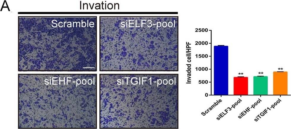 ELF3, EHF, and TGIF1 enhances the malignant phenotypes of LUAD cells.A, B Inhibition of invasive and migrate activity by knockdown master TFs, ELF3, EHF, and TGIF1. PC-9 cells were transfected with indicated siRNA-pool and subjected to invasion and migration assays (see “Materials and methods”). Invaded and migrated cells were stained with crystal violet and counted (see Fig. S3). Histograms represent the number of invasion or migration. Representative photographs were shown. C Colony assay performed on PC-9 cells transfected with either scramble or siRNA-pool targeting ELF3, EHF, and TGIF1. D Silencing of ELF3, EHF, and TGIF1 increased clonal cell growth in a 3D spheroid culture system. PC-9 cells transfected with scramble or siRNA-pool were cultured as spheroid in DMEM medium and the spheroids was observed after 48 h. E Inhibition of cell migration by knockdown master TFs, ELF3, EHF, and TGIF1. PC-9 cells were transfected with indicated siRNA-pool and subjected to scratch assay (see “Materials and methods”). Representative photographs were taken and migration areas were measured. Statistical analysis was performed by using t tests; data are shown as bar graphs of the mean ± SD. of three independent experiments. Scale bars (white) indicate 250 μm. F The effects of pcDNA3.1-ELF3 and/or pcDNA3.1-EHF co-transfected with TGIF1 siRNA on cell migration and invasiveness in LUAD cells were examined by Transwell assays using a Boyden chamber in the presence or absence of Matrigel, respectively. Histograms represent the number of invasion or migration. Data were representative of two to three separate experiments performed in triplicate. *p < 0.05; **p < 0.01; ***p < 0.001. Image collected and cropped by CiteAb from the following publication (//pubmed.ncbi.nlm.nih.gov/33070167), licensed under a CC-BY license. Not internally tested by R&D Systems.