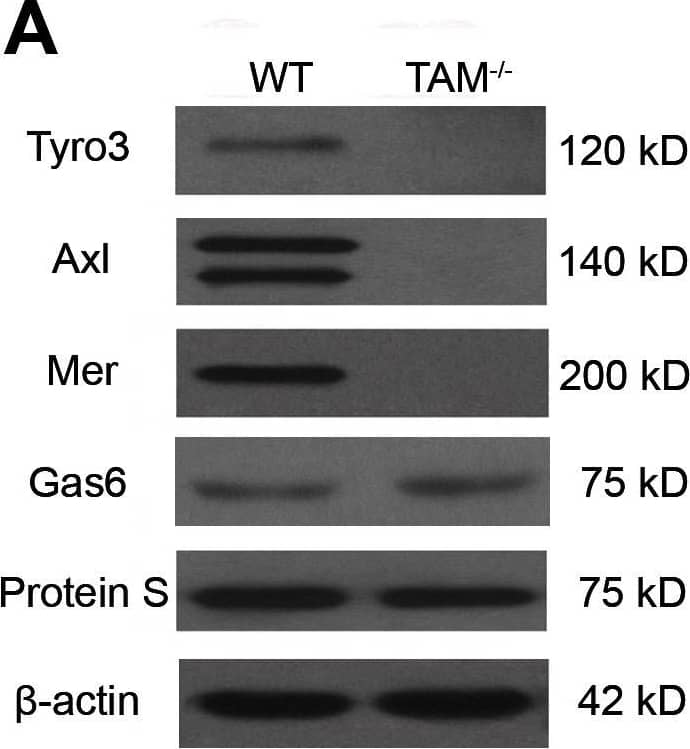 Expression of TAM RTKs, Gas6 and Protein S.(A) Western blot analyses of the liver lysates for the examination of TAM RTKs, Gas6 and Protein S. (B) Expression of TAM RTKs, Gas6 and Protein S in isolated liver cells: parenchymal cells (PCs), Kupffer cells(KCs) and sinusoidal endothelial cells (SECs). The primary cells were subjected to Western blotting. (C) Immunohistochemistry for the detection of TAM RTKs, Gas6 and Protein S. Arrowheads indicate PCs, and arrows indicate spindle-shaped sinusoidal cells corresponding to KCs and SECs. In negative controls (islets), sections were incubated with primary antibodies pre-incubated with an excess of blocking peptide. The livers of 15-week-old WT mice were used for the protein analyses. The images are representatives of at least three experiments. Scale bar  = 20 µm. Image collected and cropped by CiteAb from the following open publication (//pubmed.ncbi.nlm.nih.gov/23799121), licensed under a CC-BY license. Not internally tested by R&D Systems.