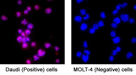 FoxO1/FKHR was detected in immersion fixed Daudi Human Burkitt's Lymphoma Cell Line (Positive) and MOLT‑4 Human Acute Lymphoblastic Leukemia Cell Line (Negative) Cells using Mouse Anti-Human FoxO1/FKHR Monoclonal Antibody (Catalog # MAB5939) at 5 &micro;g/mL for 3 hours at room temperature. Cells were stained using the NorthernLights&trade; 557-conjugated Anti-Mouse IgG Secondary Antibody (red; Catalog # NL007) and counterstained with DAPI (blue). Specific staining was localized to cell nuclei. View our protocol for Fluorescent ICC Staining of Non-adherent Cells.