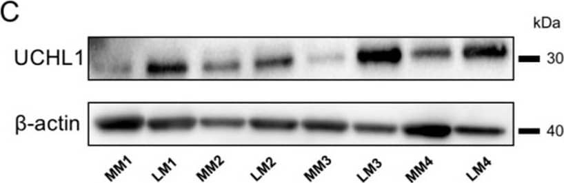 UCHL1 was highly expressed in human leiomyoma. (A–C) Strong expression of UCHL1 was observed by (A) immunohistochemistry, (B) real-time PCR, and (C) Western blotting in leiomyoma. The scale bar shows 50 µm. The bar shows the standard error (* p < 0.05, ** p < 0.01). Image collected and cropped by CiteAb from the following open publication (//pubmed.ncbi.nlm.nih.gov/36830563), licensed under a CC-BY license. Not internally tested by R&D Systems.