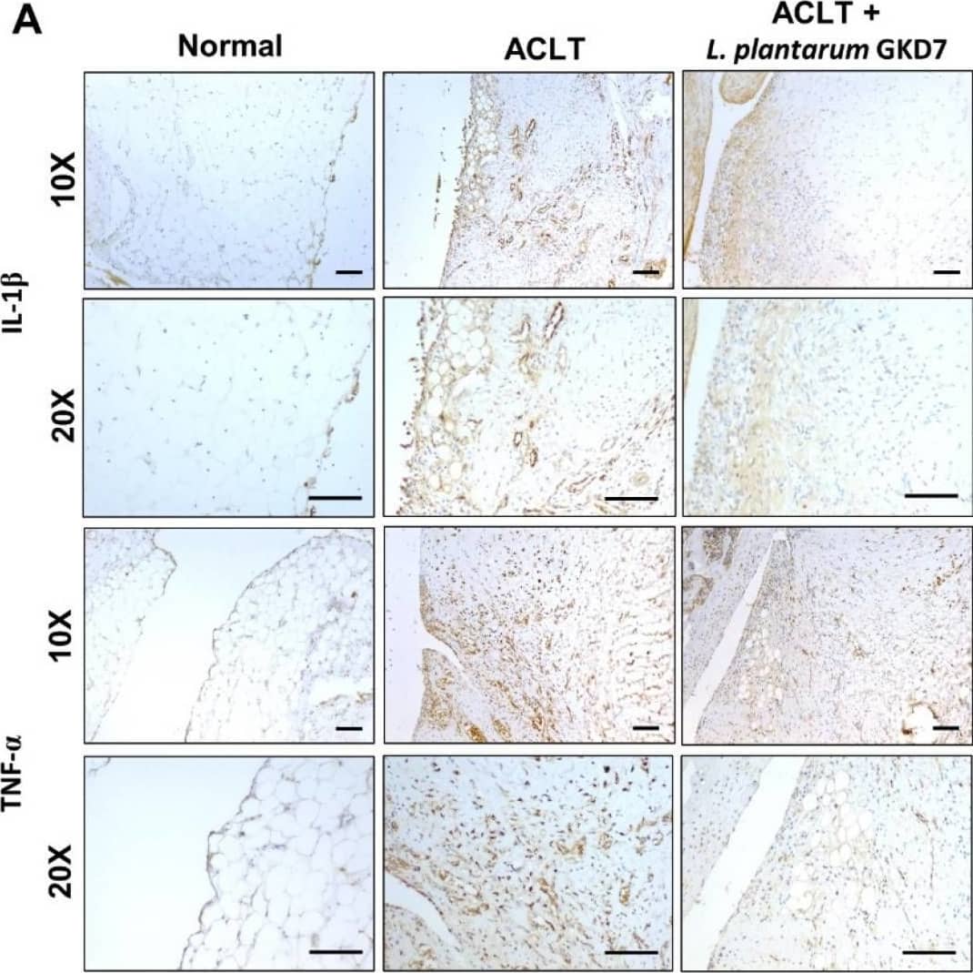 Oral live L. plantarum GKD7 reduced levels of TNF-alpha  and IL-1 beta  expression in OA synovium. (A) IHC staining of IL-1 beta  and TNF-alpha  in representative synovium from controls, ACLT-only rats, and ACLT + L. plantarum GKD7 rats. Quantitative analyses of (B) IL-1 beta  and (C) TNF-alpha  in synovium. Scale bar = 100 µm. * p < 0.05 vs. controls; # p < 0.05 vs. the ACLT-only group. Image collected and cropped by CiteAb from the following open publication (//pubmed.ncbi.nlm.nih.gov/35956346), licensed under a CC-BY license. Not internally tested by R&D Systems.