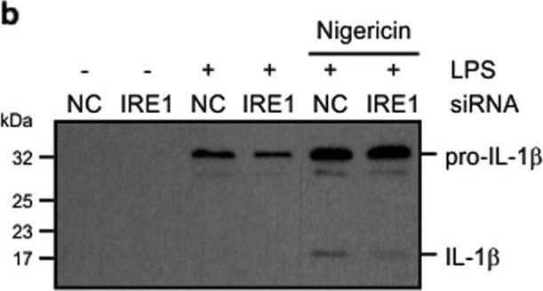 Knockdown of IRE1 alpha  reduces LPS-induced cytokine production.THP-1 cells transfected with either noncoding (NC) or IRE1 alpha  targeting siRNA were treated with either 1 μg/ml LPS alone for 24 h or 1 μg/ml LPS for 24 h followed by addition of 10 μM nigericin (NG) for 45 min. a Cell lysates were analysed via immunoblotting for IRE1 alpha , phospho-p65, total p65, NLRP3, pro-caspase-1 and pro-IL-1 beta . Actin was used as a loading control. b Cell conditioned medium was analysed via immunoblotting for pro-IL-1 beta  processing. c–f Levels of IL-1 beta , IL-8, TNF-alpha , and IL-6 were assayed in cell conditioned medium by ELISA (n = 3). *P < 0.05, **P < 0.01, and ***P < 0.001 based on a Student’s t test. Error bars represent SD Image collected and cropped by CiteAb from the following open publication (//pubmed.ncbi.nlm.nih.gov/31417078), licensed under a CC-BY license. Not internally tested by R&D Systems.