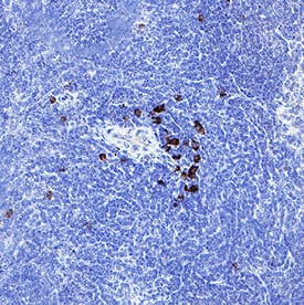 IL‑12/IL‑23 p40 was detected in immersion fixed paraffin-embedded sections of Mouse Spleen using Rat Anti-MouseIL‑12/IL‑23 p40 Monoclonal Antibody (Catalog # MAB6092) at 5 &micro;g/mL for 1 hour at room temperature followed by incubation with the Anti-Rat IgG VisUCyte&trade; HRP Polymer Antibody (Catalog # VC005). Before incubation with the primary antibody, tissue was subjected to heat-induced epitope retrieval using VisUCyte Antigen Retrieval Reagent-Basic (Catalog # VCTS021). Tissue was stained using DAB (brown) and counterstained with hematoxylin (blue). Specific staining was localized to cytoplasm in lymphocytes. View our protocol for IHC Staining with VisUCyte HRP Polymer Detection Reagents.