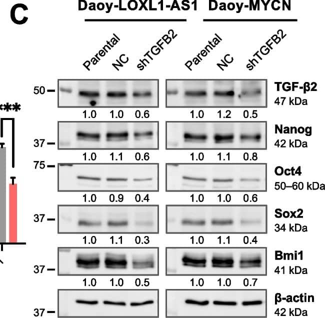 Effects of transforming growth factor (TGF)-beta 2 silencing on metastatic phenotypes of sonic-hedgehog medulloblastoma cells with high LOXL1-AS1 expression. A RT-qPCR analysis of TGF-beta 2 expression in Daoy-LOXL1-AS1 and Daoy-MYCN cells. B RT-qPCR analysis of four stemness markers in Daoy-LOXL1-AS1 and Daoy-MYCN cells relative to the parental group. C Western blot analysis of four stemness markers in Daoy-LOXL1-AS1 and Daoy-MYCN cells. Quantification values below each band are relative to the parental group. D, G Sphere-formation assay of (D) Daoy-LOXL1-AS1 and (G) Daoy-MYCN cells, including microscopic images (left images), and the number and sizes of spheres of ≥150 μm in diameter (right bar chart). Scale bars, 500 μm in 4× and 100 μm in 20× magnification. E, H Wound-healing assay of (E) Daoy-LOXL1-AS1 and (H) Daoy-MYCN cells. F, I Transwell migration and invasion assays of (F) Daoy-LOXL1-AS1 and (I) Daoy-MYCN cells including quantification of cell migration (left bar chart) and invasion (right bar chart). Quantitative data are presented as mean ± SD of replicates from representative of three independent experiments. NC, negative control; ns, non-significant. * p < 0.05, ** p < 0.01, *** p < 0.001 Image collected and cropped by CiteAb from the following open publication (//jeccr.biomedcentral.com/articles/10.1186/s13046-024-03057-0), licensed under a CC-BY license. Not internally tested by R&D Systems.
