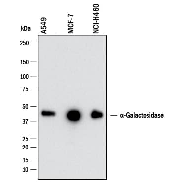 Western blot shows lysates of A549 human lung carcinoma cell line, MCF‑7 human breast cancer cell line and NCI‑H460 human large cell lung carcinoma cell line. PVDF membrane was probed with 1 µg/mL of Rabbit Anti-Human  alpha ‑Galactosidase A/GLA Monoclonal Antibody (Catalog # MAB61462) followed by HRP-conjugated Anti-Rabbit IgG Secondary Antibody (Catalog # HAF008). A specific band was detected for  alpha ‑Galactosidase A/GLA at approximately 45 kDa (as indicated). This experiment was conducted under reducing conditions and using Western Blot Buffer Group 1.