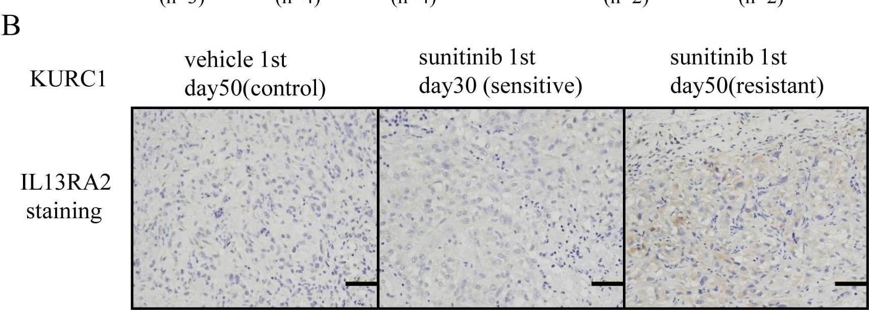 Immunohistochemistry IL-13R alpha 2 Antibody (83834) [Unconjugated]