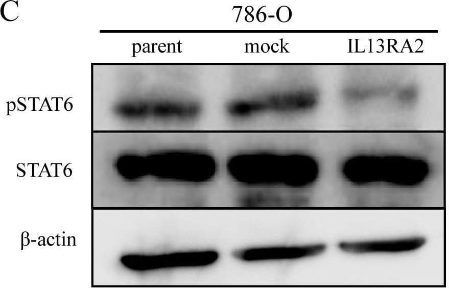 Western Blot IL-13R alpha 2 Antibody (83834) [Unconjugated]