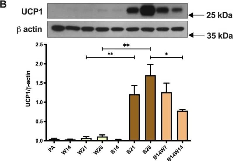 Western Blot UCP1 Antibody (536435) [Unconjugated]