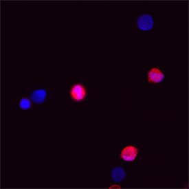 Caspase‑1 was detected in immersion fixed PC‑3 human prostate cancer cell line (positive staining) and U937 human histiocytic lymphoma cell line (negative control) using Rabbit Anti-Human Caspase‑1 Monoclonal Antibody (Catalog # MAB62156) at 8 &micro;g/mL for 3 hours at room temperature. Cells were stained using the NorthernLights&trade; 557-conjugated Anti-Rabbit IgG Secondary Antibody (red; NL004) and counterstained with DAPI (blue). Specific staining was localized to cell nuclei and cytoplasm. Staining was performed using our protocol for Fluorescent ICC Staining of Non-adherent Cells.