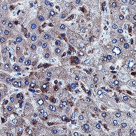 Caspase‑1 was detected in immersion fixed paraffin-embedded sections of human lymph node using Rabbit Anti-Human Caspase‑1 Monoclonal Antibody (Catalog # MAB62156) at 3 &micro;g/mL for 1 hour at room temperature followed by incubation with the Anti-Rabbit IgG VisUCyte&trade; HRP Polymer Antibody (VC003). Before incubation with the primary antibody, tissue was subjected to heat-induced epitope retrieval using Antigen Retrieval Reagent-Basic (CTS013). Tissue was stained using DAB (brown) and counterstained with hematoxylin (blue). Specific staining was localized to cytoplasm in Kupffer cells. Staining was performed using our protocol for IHC Staining with VisUCyte HRP Polymer Detection Reagents.