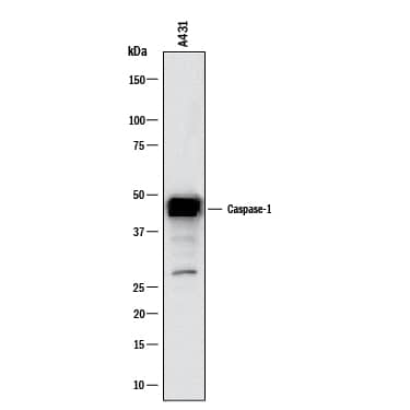 Western blot shows lysates of A431 human epithelial carcinoma cell line. PVDF membrane was probed with 2 µg/mL of Rabbit Anti-Human Caspase‑1 Monoclonal Antibody (Catalog # MAB62156) followed by HRP-conjugated Anti-Rabbit IgG Secondary Antibody (HAF008). A specific band was detected for Caspase‑1 at approximately 48 kDa (as indicated). This experiment was conducted under reducing conditions and using Western Blot Buffer Group 1.