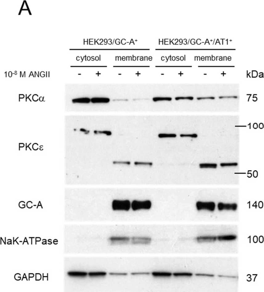 Western Blot NPRA/NPR1 Antibody (377018) [Unconjugated]