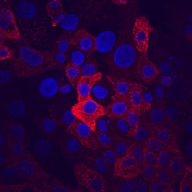MUC-1 was detected in immersion fixed Capan-1 human pancreatic adenocarcinoma cell line using Mouse Anti-Human MUC-1 Monoclonal Antibody (Catalog # MAB6298) at 10 µg/mL for 3 hours at room temperature. Cells were stained using the NorthernLights™ 557-conjugated Anti-Mouse IgG Secondary Antibody (red; NL007) and counterstained with DAPI (blue). Specific staining was localized to cell surfaces and cytoplasm. View our protocol for Fluorescent ICC Staining of Cells on Coverslips.