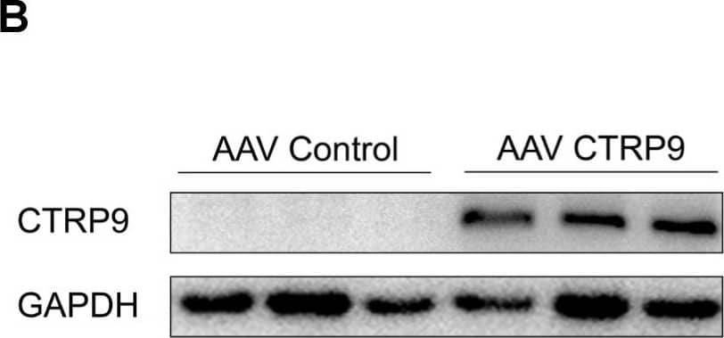 Western Blot CTRP9/C1qTNF9 Antibody (653533) [Unconjugated]