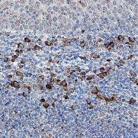 DNAM-1/CD226 was detected in immersion fixed paraffin-embedded sections of human tonsil using Mouse Anti-Human DNAM-1/CD226 Monoclonal Antibody (Catalog # MAB6661) at 5 &micro;g/mL for 1 hour at room temperature followed by incubation with the Anti-Mouse IgG VisUCyte&trade; HRP Polymer Antibody (VC001). Before incubation with the primary antibody, tissue was subjected to heat-induced epitope retrieval using Antigen Retrieval Reagent-Basic (CTS013). Tissue was stained using DAB (brown) and counterstained with hematoxylin (blue). Specific staining was localized to cytoplasm in lymphocytes. Staining was performed using our protocol for IHC Staining with VisUCyte HRP Polymer Detection Reagents.
