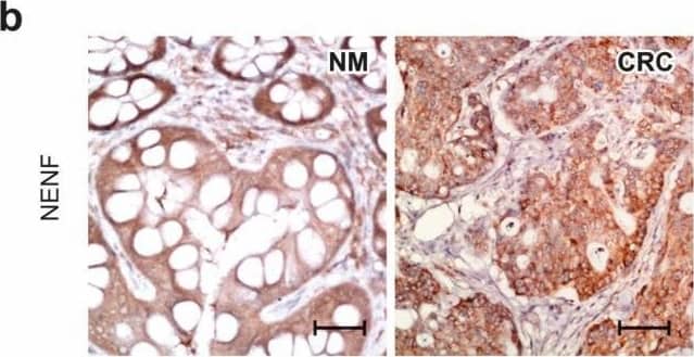 Immunohistochemistry Neudesin Antibody (737130)