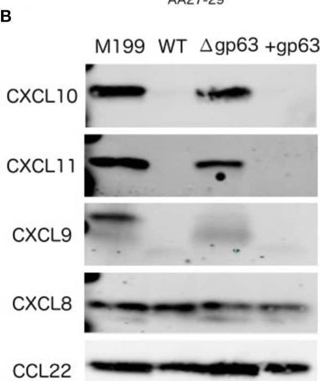 CXCL10 cleavage by GP63 occurs between positions A81 and I82.(B) GP63 selectively cleaves chemokine ligands of the CXCR3 receptor. Conditioned media from L. major WT,  delta gp63, and  delta gp63+1 was incubated with human recombinant chemokines for 12 h and product detected by western blot. Cleavage is only detected for the CXCL9/10/11 family. Representative blots are shown from at least two independent experiments. Image collected and cropped by CiteAb from the following open publication (//pubmed.ncbi.nlm.nih.gov/31440475), licensed under a CC-BY license. Not internally tested by R&D Systems.