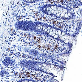 RANK/TNFRSF11A was detected in immersion fixed paraffin-embedded sections of Human Colon using Mouse Anti-Human RANK/TNFRSF11A Monoclonal Antibody (Catalog # MAB6832) at 5 &micro;g/mL for 1 hour at room temperature followed by incubation with the Anti-Mouse IgG VisUCyte&trade; HRP Polymer Antibody (Catalog # VC001). Before incubation with the primary antibody, tissue was subjected to heat-induced epitope retrieval using VisUCyte Antigen Retrieval Reagent-Basic (Catalog # VCTS021). Tissue was stained using DAB (brown) and counterstained with hematoxylin (blue). Specific staining was localized to cytoplasm in lymphocytes. View our protocol for IHC Staining with VisUCyte HRP Polymer Detection Reagents.