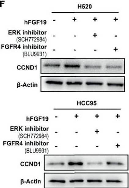 Western Blot FGFR4 Antibody (240929) [Unconjugated]