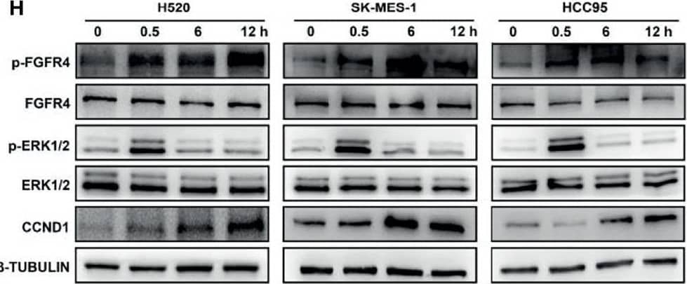 Western Blot FGFR4 Antibody (240929) [Unconjugated]