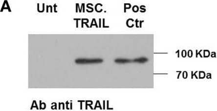 Diabody single-chain TNF-related apoptosis-inducing ligand (Db-scTRAIL) released by mesenchymal stem cell (MSC).TRAIL cell line induces specific apoptotic activity in Colo205. (A) Immunoblotting of purified Db-scTRAIL from MSC untransfected (Unt) and MSC.TRAIL cell culture medium (5 days), using a specific antibody anti TRAIL. Three micrograms of purified Db-scTRAIL were used as positive control (Pos Ctr). (B) The bioactivity of the secreted Db-scTRAIL was tested after 18 h of coculture of MSC lines and Colo205 (ratios 1:5 and 1:50). The cocultures were treated in combination with bortezomib (BZB) (250 ng/ml) and/or TRAIL blocking antibody (1 μg/ml). Cell viability was analyzed using crystal violet staining and data were normalized using Colo205 cells treated with BZB as control (mean ± SD, n = 3). (C) Colo205 cells were seeded in the lower chamber of a transwell (8 × 104 cells). After overnight cultivation, the stable cell lines (Mock.TRAIL and MSC.TRAIL) were seeded in the upper chamber (1.6 × 104 cells) and BZB (250 ng/ml) was added to the medium. After 18 h of treatment, Colo205 were collected, stained with the specific cleaved caspase-3 antibody (Asp 175), and analyzed by flow cytometry (mean ± SD, n = 4). Image collected and cropped by CiteAb from the following open publication (//pubmed.ncbi.nlm.nih.gov/28553285), licensed under a CC-BY license. Not internally tested by R&D Systems.