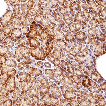 NIK/MAP3K14 was detected in immersion fixed paraffin-embedded sections of human pancrease using Mouse Anti-Human NIK/MAP3K14 Monoclonal Antibody (Catalog # MAB6888R) at 5 &micro;g/mL for 1 hour at room temperature followed by incubation with the Anti-Mouse IgG VisUCyte&trade; HRP Polymer Antibody (Catalog # VC001). Before incubation with the primary antibody, tissue was subjected to heat-induced epitope retrieval using VisUCyte Antigen Retrieval Reagent-Basic (Catalog # VCTS021). Tissue was stained using DAB (brown) and counterstained with hematoxylin (blue). Specific staining was localized to cytoplasm in exocrine and endocrine cells. View our protocol for IHC Staining with VisUCyte HRP Polymer Detection Reagents.
