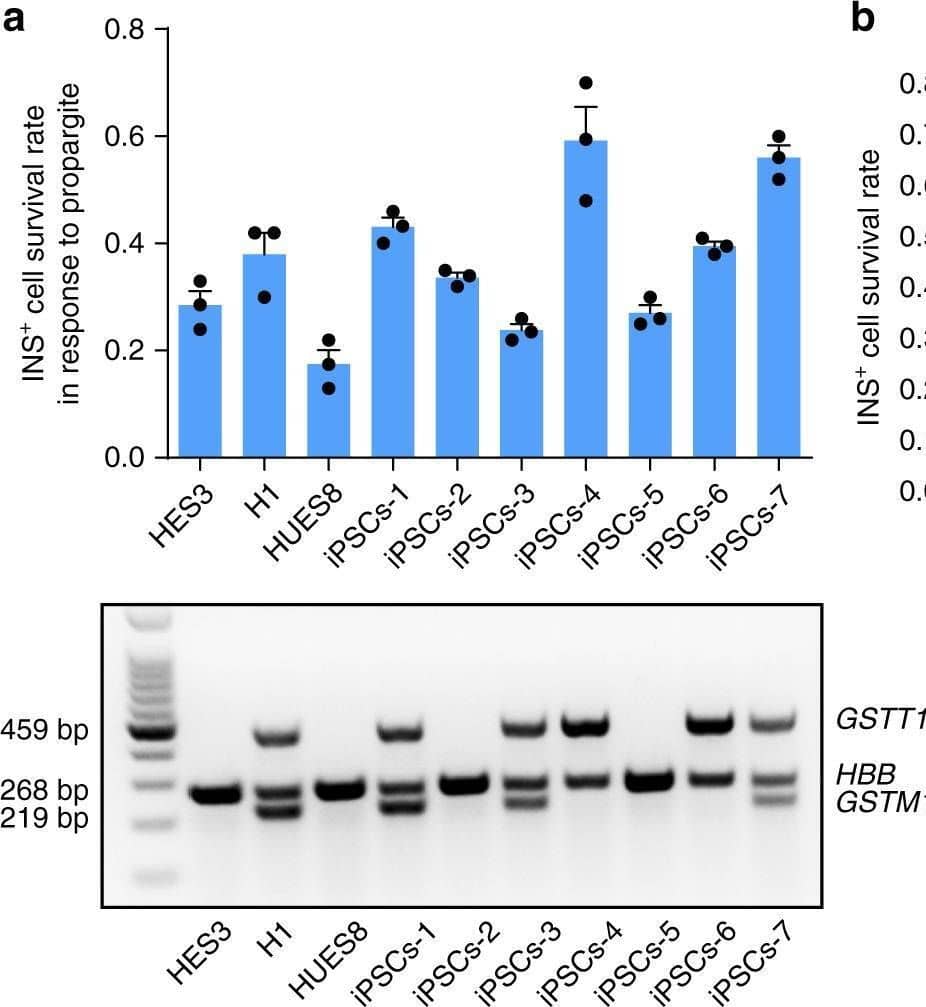 A hPSC-based population study discovers that GSTT1-null pancreatic  beta -like cells are hypersensitive to propargite-induced cell death. a Survival rate of INS+ cells derived from 10 different hESC or iPSC lines cultured in the presence of 1.6 μM propargite (n = 3), and genotype analysis of GSTM1 and GSTT1 in those hESCs and iPSCs. b, c Correlation of INS+ cell survival rate in the presence of 1.6 μM propargite in cells lacking both GSTM1 and GSTT1 (b), or lacking only GSTM1 (c). n.s. indicates a non-significant difference. d Western blotting analysis of GSTT1 or GSTM1 protein expression in INS+ cells derived from isogenic wild type, GSTT1−/− or GSTM1−/− H1 hESCs. The −/− null clones were CRSIPR-induced biallelic frameshift mutants. The two GSTT1 knockout clones were both homozygous null mutants, and the two GSTM1 knockout clones were both compound-null mutants. e Flow cytometry analysis of C-peptide+ cells in isogenic GSTT1−/− or GSTM1−/− hESC-derived D18 cells. f Inhibition curve of propargite on INS+ cells derived from GSTT1+/+ or GSTT1−/− H1 hESCs (n = 3). g, h Representative images (g) and DNA damage rate (h) of GSTT1+/+ and GSTT1−/−  beta -like cells (n = 3). Scale bars, 800 μm.  gamma -H2A.X +/INS+ cells are highlighted with yellow arrows. i Western blot analysis of GSTT1 protein in EndoC-beta H1 cells carrying sgGSTT1. Two CRISPR gRNAs (sgGSTT1-1 and sgGSTT1-2) were used for generating GSTT1−/− EndoC-beta H1 cells. j, k Representative images (j) and cell death rate (k) of GSTT1−/− EndoC-beta H1 cells treated with 1.6 μM propargite (n = 3). Scale bars, 200 μm. Values presented as mean ± S.D. n.s. indicates a non-significant difference. p values calculated by unpaired two-tailed Student’s t-test were *p < 0.05, ***p < 0.001. Related to Supplementary Fig. 3 Image collected and cropped by CiteAb from the following open publication (//pubmed.ncbi.nlm.nih.gov/30446643), licensed under a CC-BY license. Not internally tested by R&D Systems.
