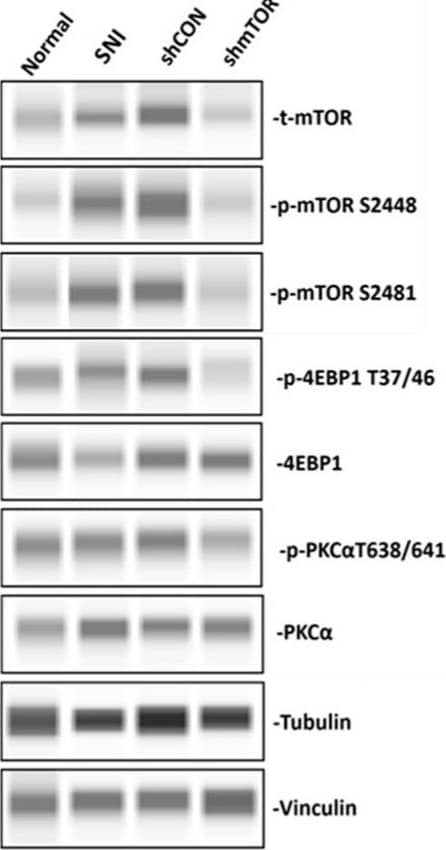 Simple Western: Vinculin Antibody (728526) [Unconjugated] [MAB6896] - Western blot analysis for expression levels of mTOR and its downstream factors in the DRG on PID 21. Phosphorylated expressions of mTOR complex 1 and 2 were decreased in the shmTOR group, and its downstream effectors were downregulated as well. Data are expressed as mean  +- SEM, * p < 0.05, ** p < 0.01, **** p < 0.0001. One-way ANOVA with Tukey's multiple comparisons test. Image collected and cropped by CiteAb from the following publication (//pubmed.ncbi.nlm.nih.gov/37958901), licensed under a CC-BY license. Not internally tested by R&D Systems.