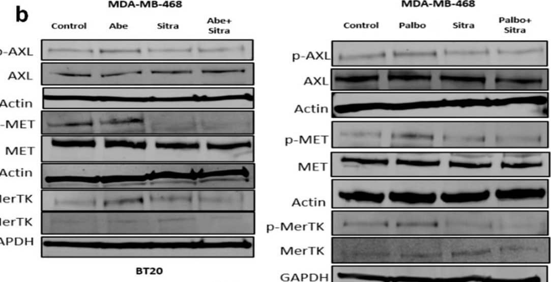 The combination of sitravatinib with abemaciclib or palbociclib is highly toxic against TNBC cells. (a) Chemical structure of sitravatinib (Sitra). (b) Immunoblot was performed on cell lines treated for 24 h with Abe (2 μm), Palbo (5 μm), and/or Sitra (2 μm). Protein levels were determined for phospho-AXL, phosho-MET, and phosho-MERTK. (c) The clonogenic assay showing that the combination of Abe or Palbo with Sitra significantly decreased the colony formation capacity of TNBC cells. Representative images of stained colonies. (d) Combination index (CI) values for the combinations of sitravatinib or merestinib with CDK4/6 inhibitor abemaciclib using different doses. Circles represent experimentally determined CI values using the Chou–Talalay method. The colors (orange and blue) represent the fixed ratio mixtures. (e,f) Overview of the toxicity and synergy scores of the drug combinations for TNBC lines. The heatmaps show the level of toxicity (e) and Bliss number (f) for the cell lines tested in this study. Average values of toxicity (e) or Bliss number (f) for cells treated with sitravatinib (S) at varying doses (S0 = No Drug, S1 = 1 μm, S2 = 2 μm, and S3 = 3 μm) in combination with either abemaciclib (A) at varying doses (A0 = No Drug, A1 = 1 μm, A2 =2 μm, A3 = 3 μm, and A4 = 4 μm) or palbociclib at varying doses (P0 = No Drug, P1 = 1 μm, P2 = 2 μm, P3 = 3 μm, and P4 = 4 μm). (g) Shown is the caspase-3/7 activity measured upon 24 h of drug treatments. The data are presented as mean ± SEM from three independent experiments, expressed as ratios to untreated control values, with associated p values as indicated (One-way ANOVA with Dunnett’s multiple comparisons test analysis). Abe: abemaciclib; Palbo: palbociclib. The original western blot figures can be found in File S1. Image collected and cropped by CiteAb from the following open publication (//pubmed.ncbi.nlm.nih.gov/38927958), licensed under a CC-BY license. Not internally tested by R&D Systems.