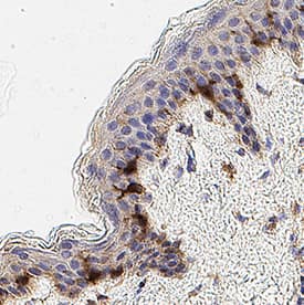 CD1a was detected in immersion fixed paraffin-embedded sections of Human Skin using Mouse Anti-Human CD1a Monoclonal Antibody (Catalog # MAB7076) at 3 µg/mL for 1 hour at room temperature followed by incubation with the Anti-Mouse IgG VisUCyte™ HRP Polymer Antibody (Catalog # VC001). Before incubation with the primary antibody, tissue was subjected to heat-induced epitope retrieval using VisUCyte Antigen Retrieval Reagent-Basic (Catalog # VCTS021). Tissue was stained using DAB (brown) and counterstained with hematoxylin (blue). Specific staining was localized to Langerhan's cells. View our protocol for IHC Staining with VisUCyte HRP Polymer Detection Reagents.